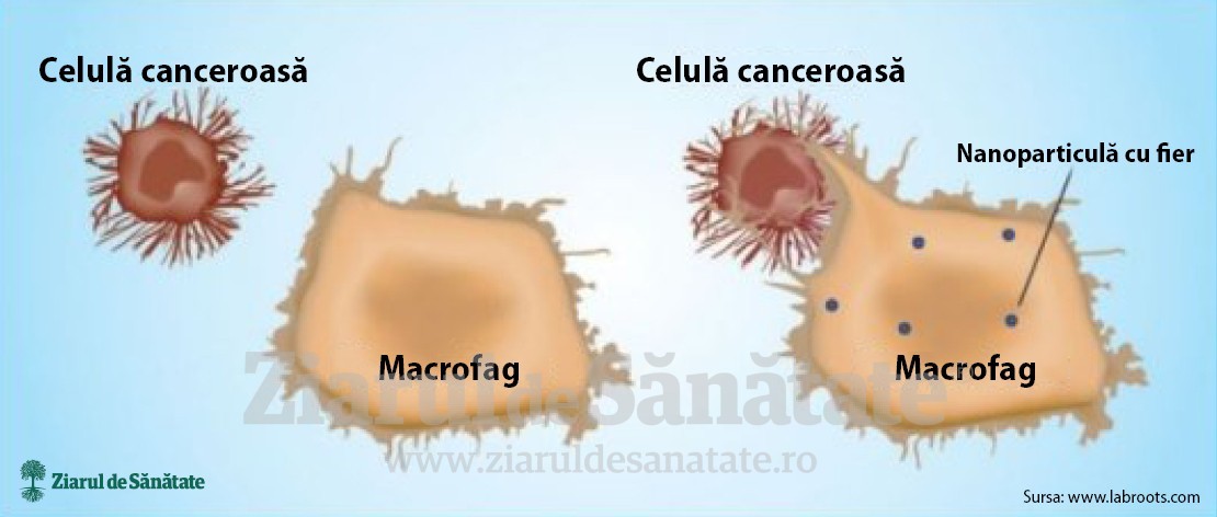 ilustratie-celule-canceroase